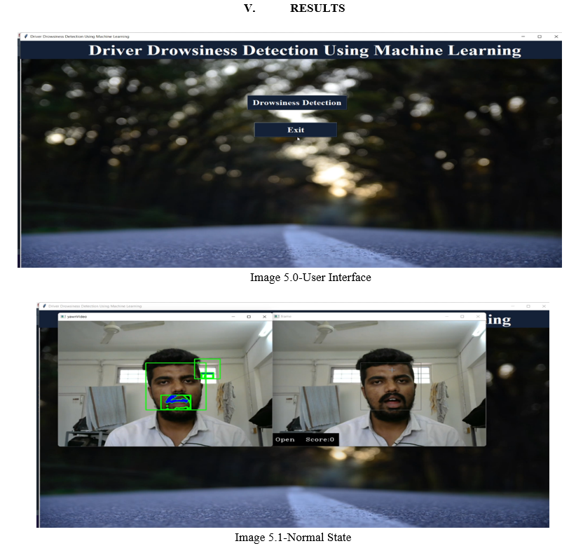 Driver Drowsiness Detection System Using Machine Learning