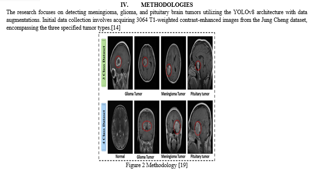 A Review of Brain Tumor Detection Techniques Using YOLOv8